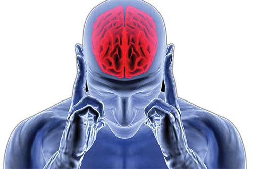 علایم ، دلایل و انواع سکته مغزی علایم ، دلایل و انواع سکته مغزی