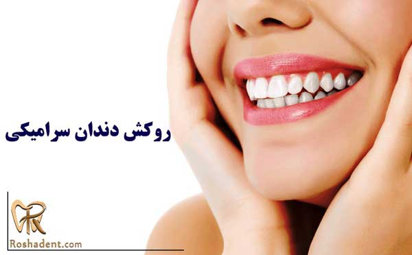 روکش دندان سرامیکی
