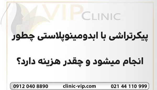 ابدومینوپلاستی چیست