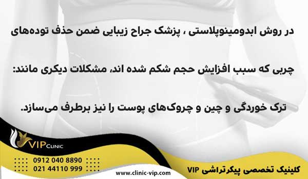 روش ابدومینوپلاستی