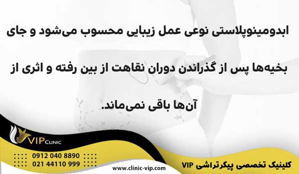پیکرتراشی با ابدومینوپلاستی