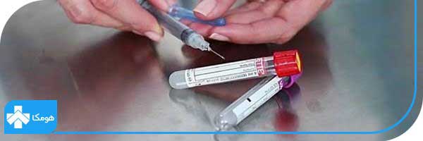 mch در آزمایش خون چیست