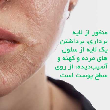 لایه برداری پوست چیست