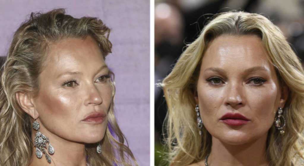 کیت ماس (Kate Moss)