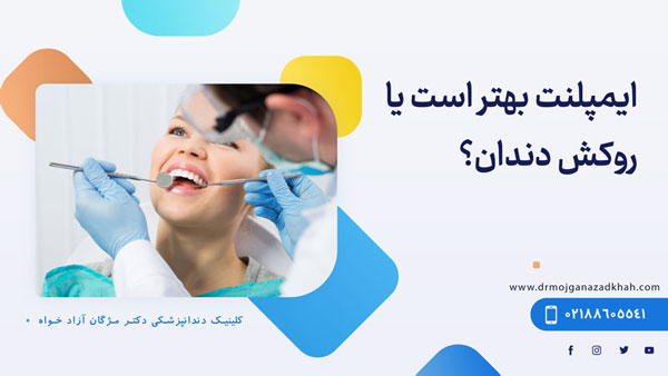 ایمپلنت بهتر است یا روکش دندان؟