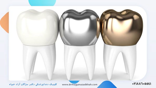 روکش دندان