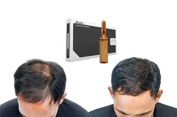 تاثیر بیوتین بر رشد مو و جلوگیری از ریزش مو