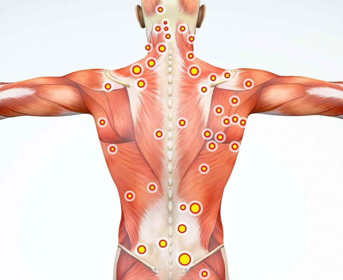ارتباط گرفتگی عضلات و روماتیسم