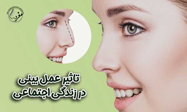 تاثیر عمل بینی در زندگی اجتماعی • مجله تصویر زندگی
