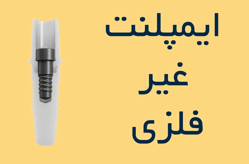 ایمپلنت غیر فلزی