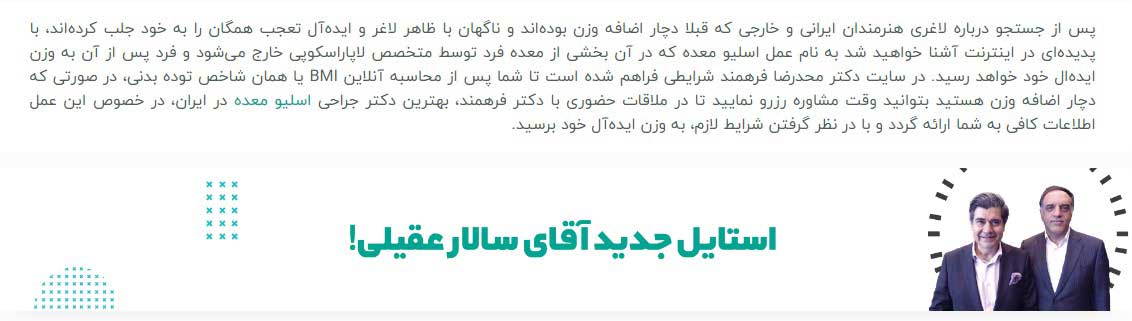 اسلیو معده سالار عقیلی
