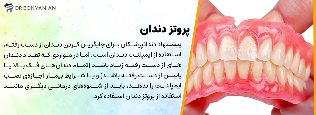 پروتز دندان