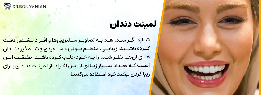 لمینت دندان
