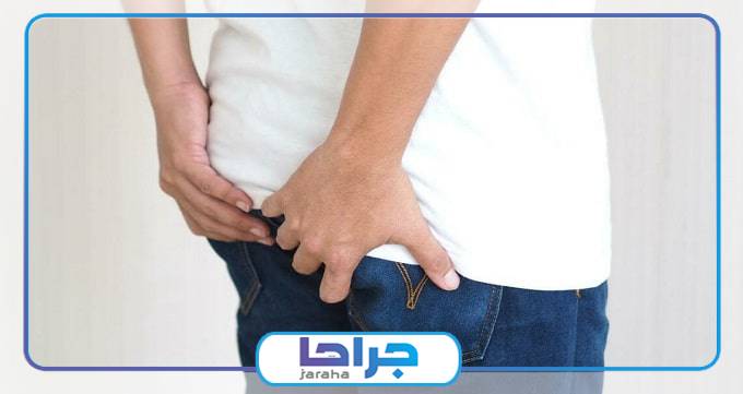 انواع زگیل تناسلی و محل رشد آن ها