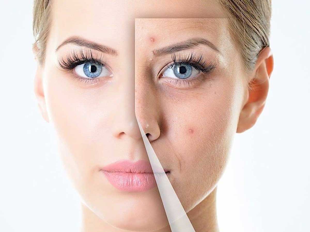 عوارض آرایش غلیظ