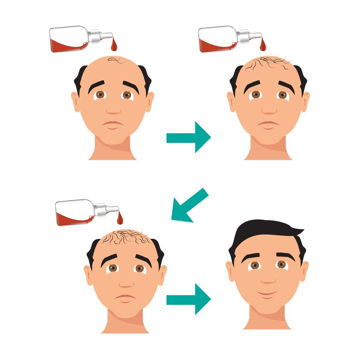 متن تبریک برای کاشت مو