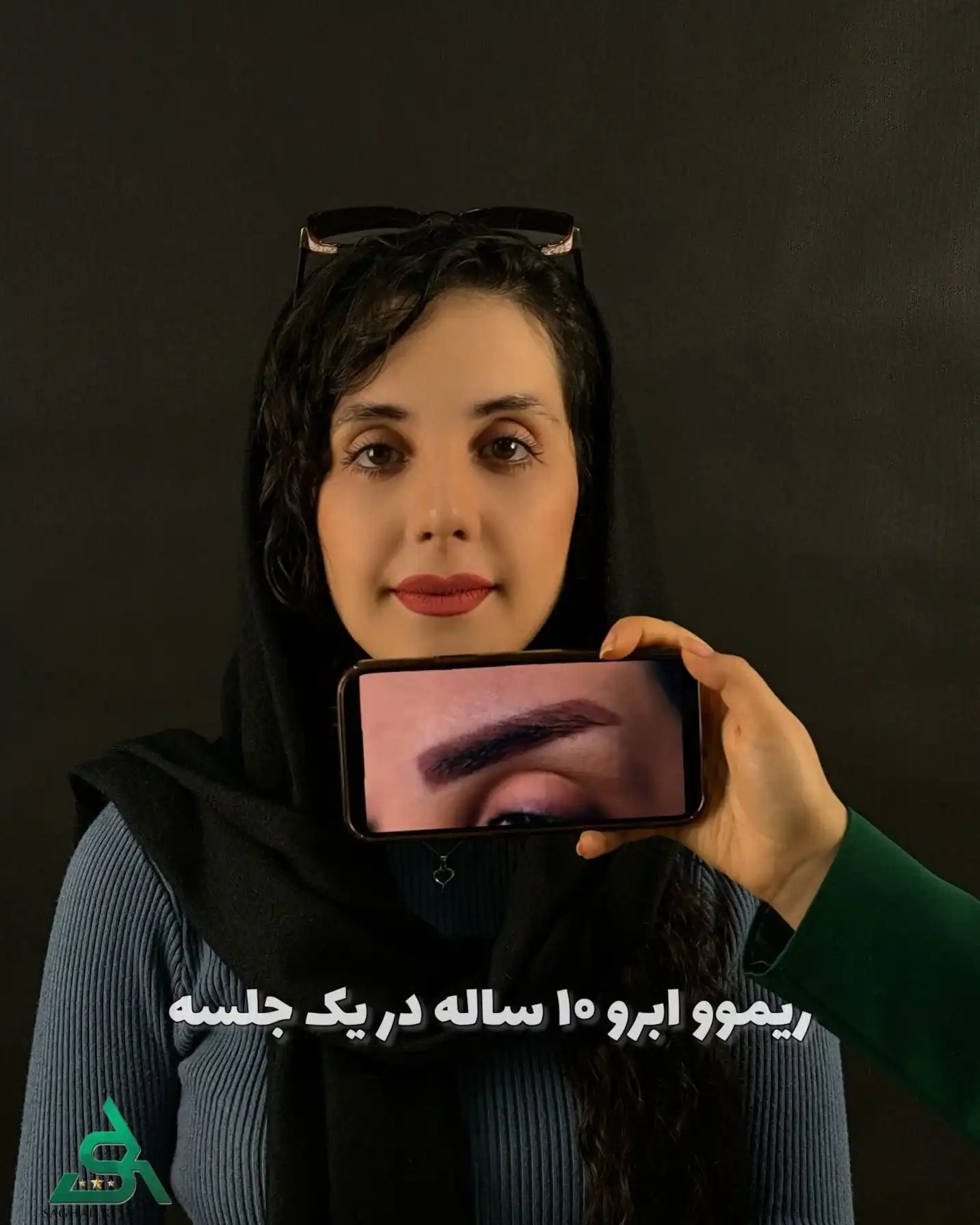 قبل و بعد از یک جلسه ریموو تاتوی ۱۰ ساله ابرو