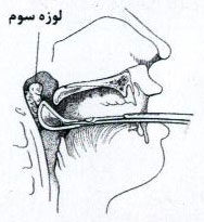 لوزه سوم : علل، علائم و درمان