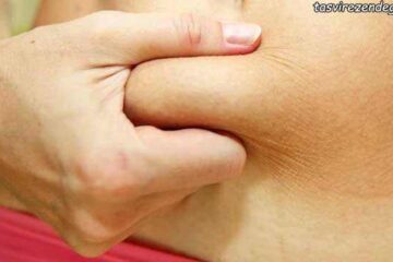 روش آب کردن چربی شکم با چند راهکار ساده