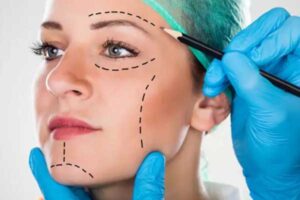 plasticsurgery