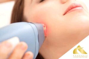 Laser hair removal