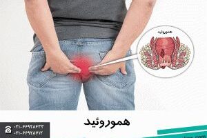 هموروئید