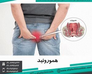 درمان هموروئید بدون درد