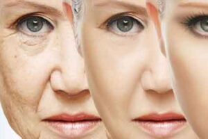 Prevent Wrinkles