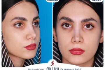 بهترین جراح بینی در تهران