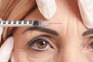 Get Younger Looking Skin