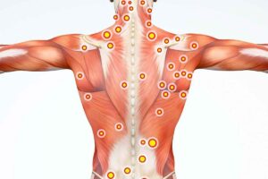 گرفتگی عضلات و روماتیسم