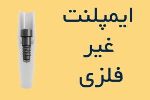 ایمپلنت غیر فلزی