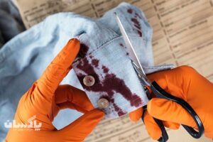 Remove the dried blood stain