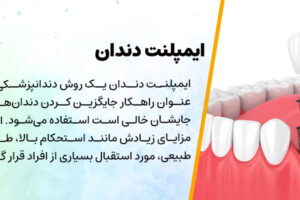 Dental implant