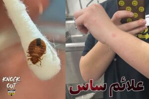 علائم ساس در منزل کدامند؟ ساس از کجا میاد؟