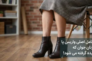 5 عامل اصلی واریس پا در زنان جوان